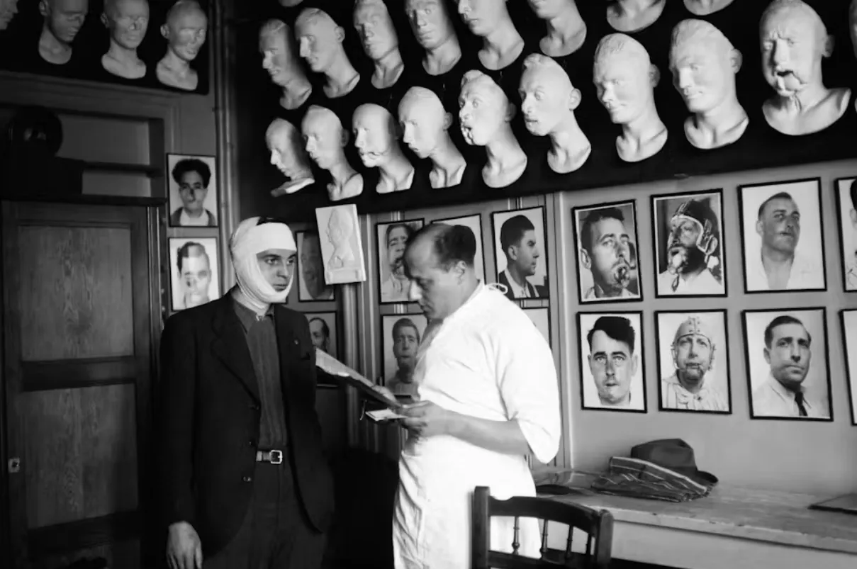 Advancements in reconstructive surgery were made after both world wars with treatments on wounded soldiers. AFP/Getty Images