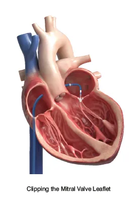 A human heart with a pipe

AI-generated content may be incorrect.