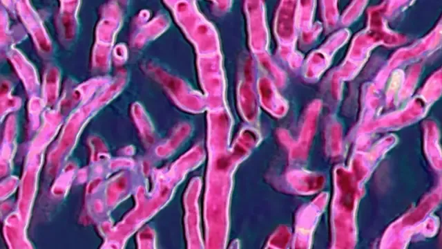 'व्हाइट फंगस': दवा प्रतिरोधी फंगल संक्रमण भारत के मरीजों के लिए खतरा