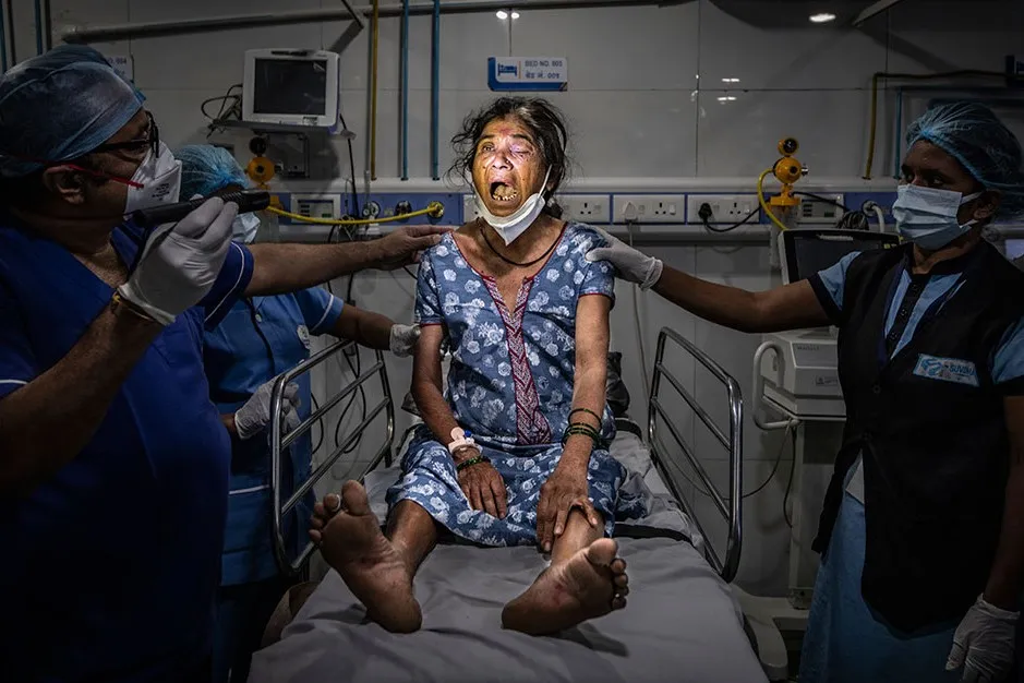 भारतीय व्यक्ति पौधे के कवक से संक्रमित होने वाला पहला व्यक्ति है