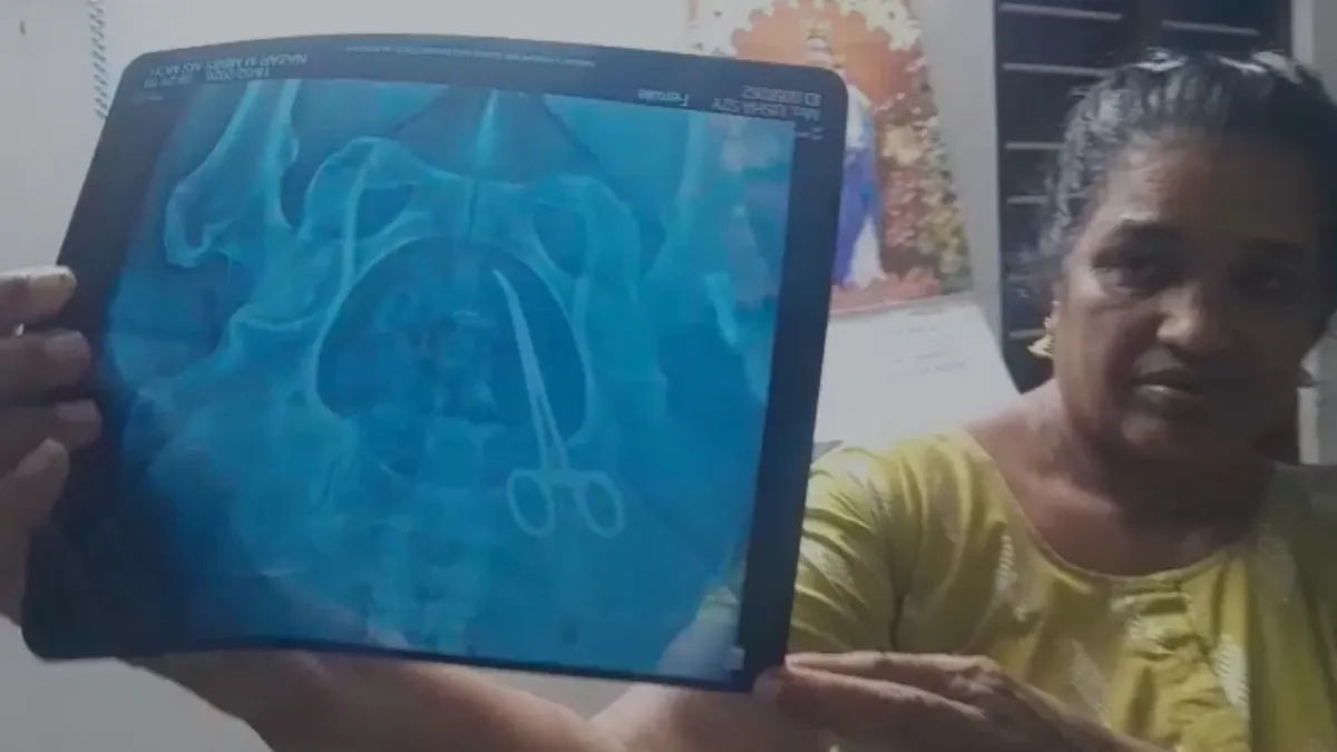 महिला के पेट में थी कैंची- India TV Hindi