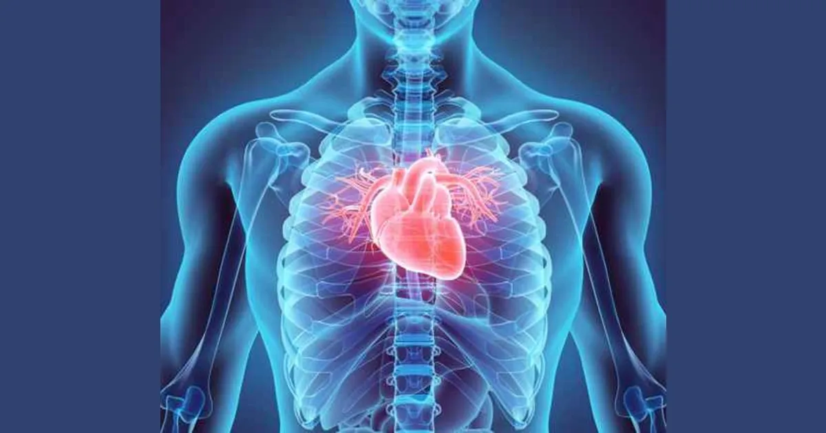 Does exercise cause heart attacks?
