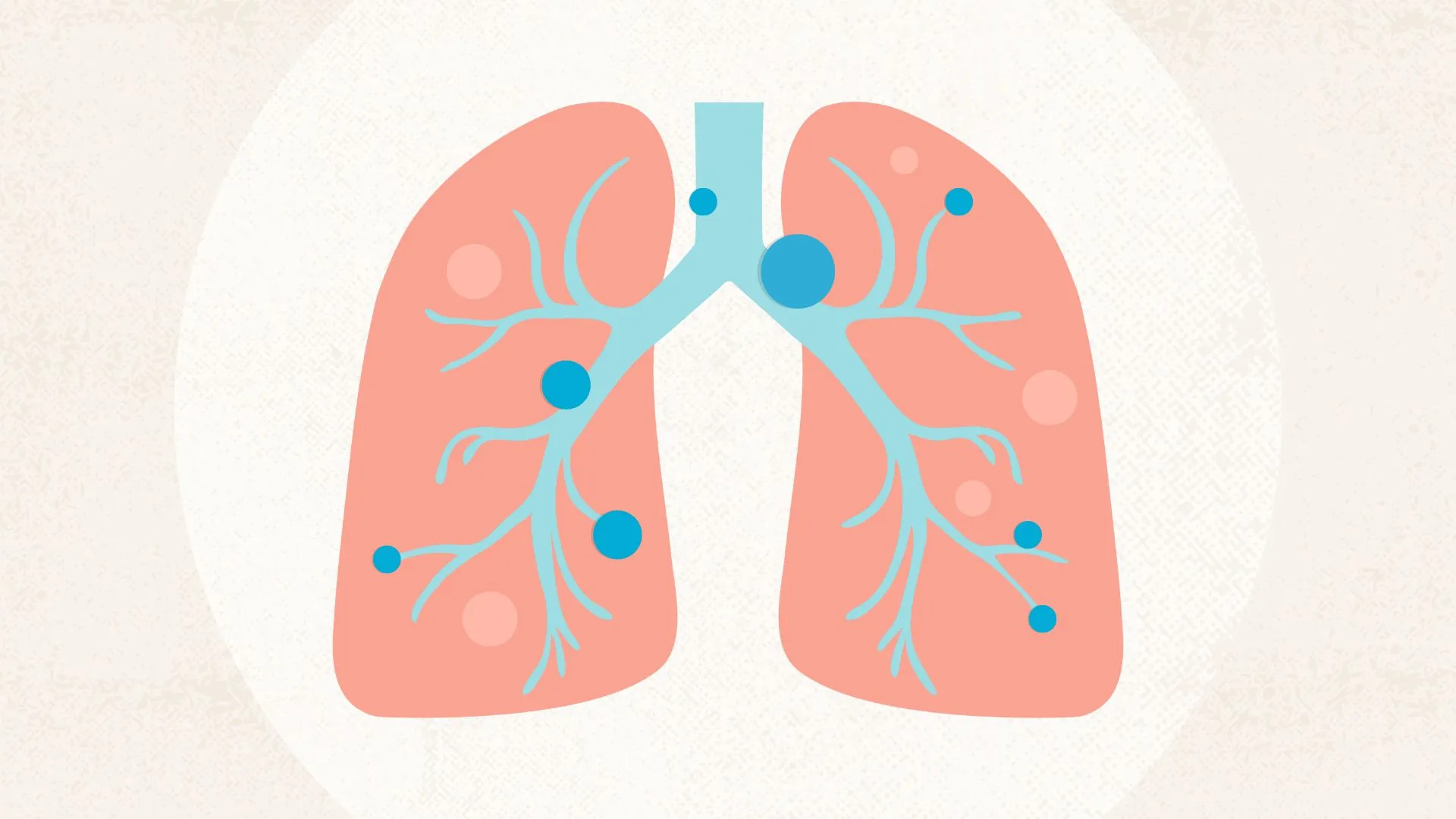 What Is Asthma? Symptoms, Causes, Diagnosis, Treatment, and Prevention | Everyday Health