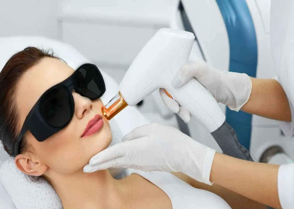 Laser Treatment