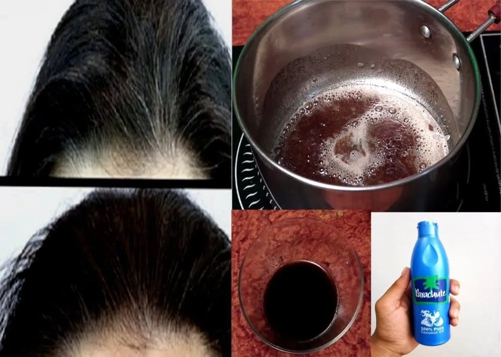 Greying of hair