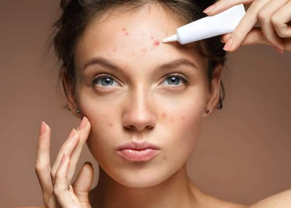 salicylic acid benefits for skin