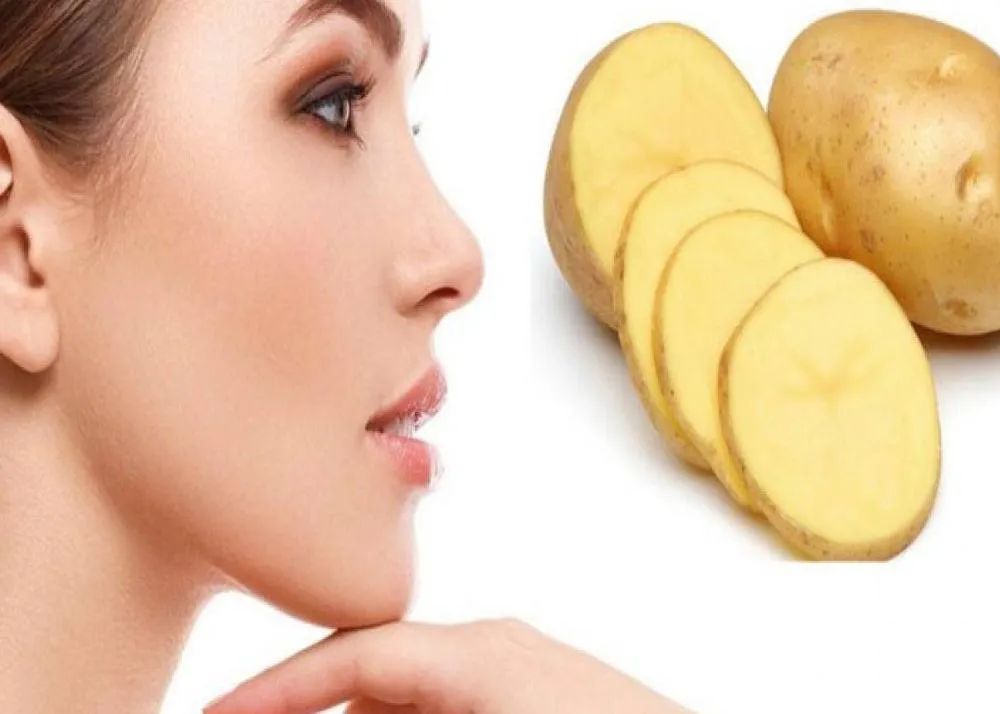 potatoes for dark circles 