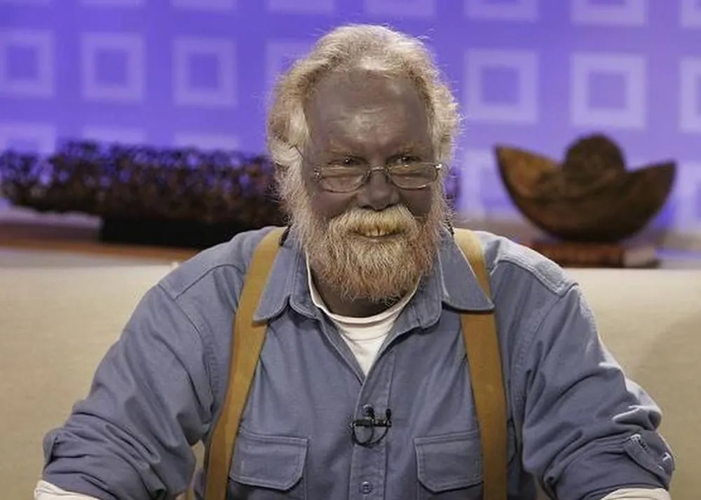 top 10 rare diseases