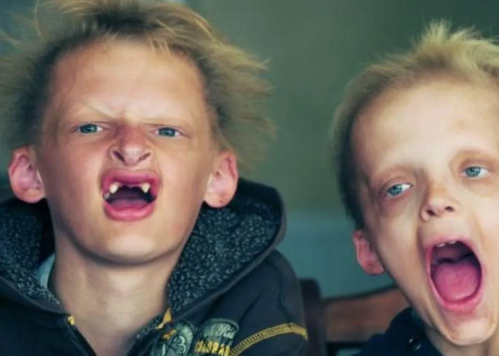 weird type of diseases