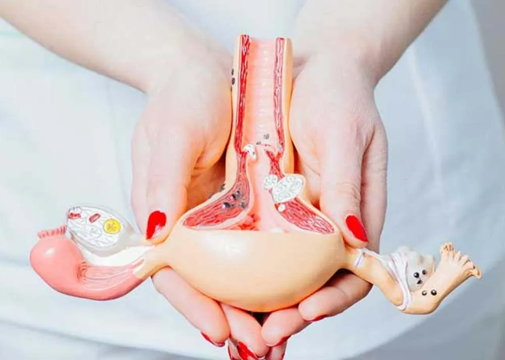 ovarian cancer treatment