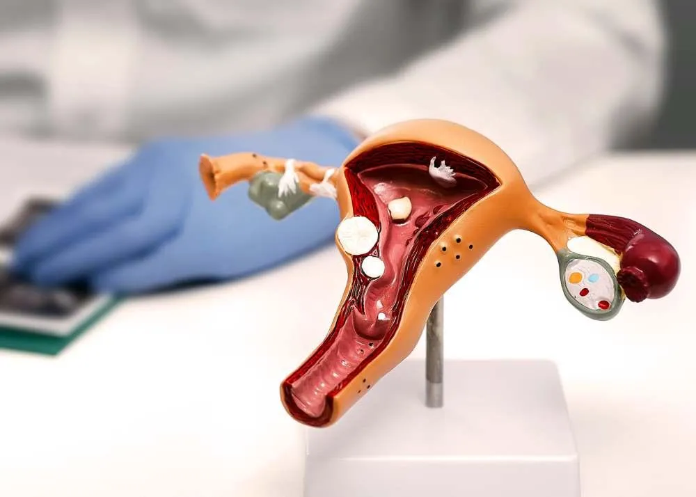 ovarian cancer symptoms