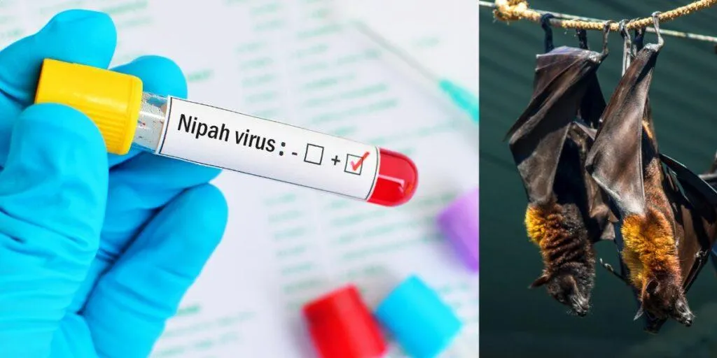  Nipah Virus