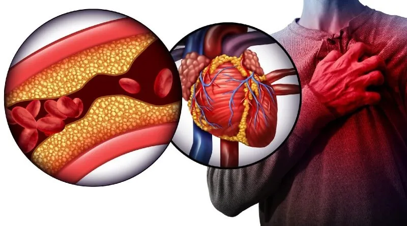 World Heart Day 2023 Heart Disease Symptoms