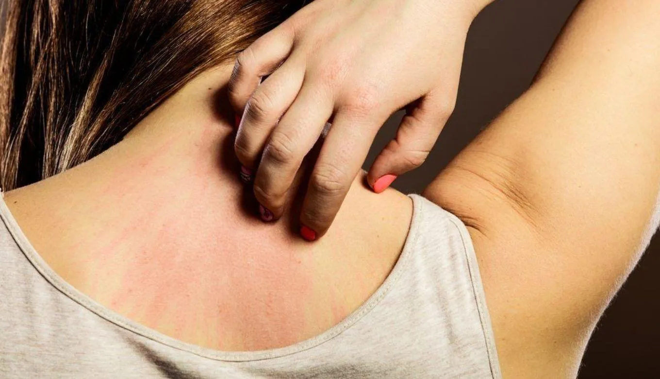 Dermatomyositis Causes, symptoms