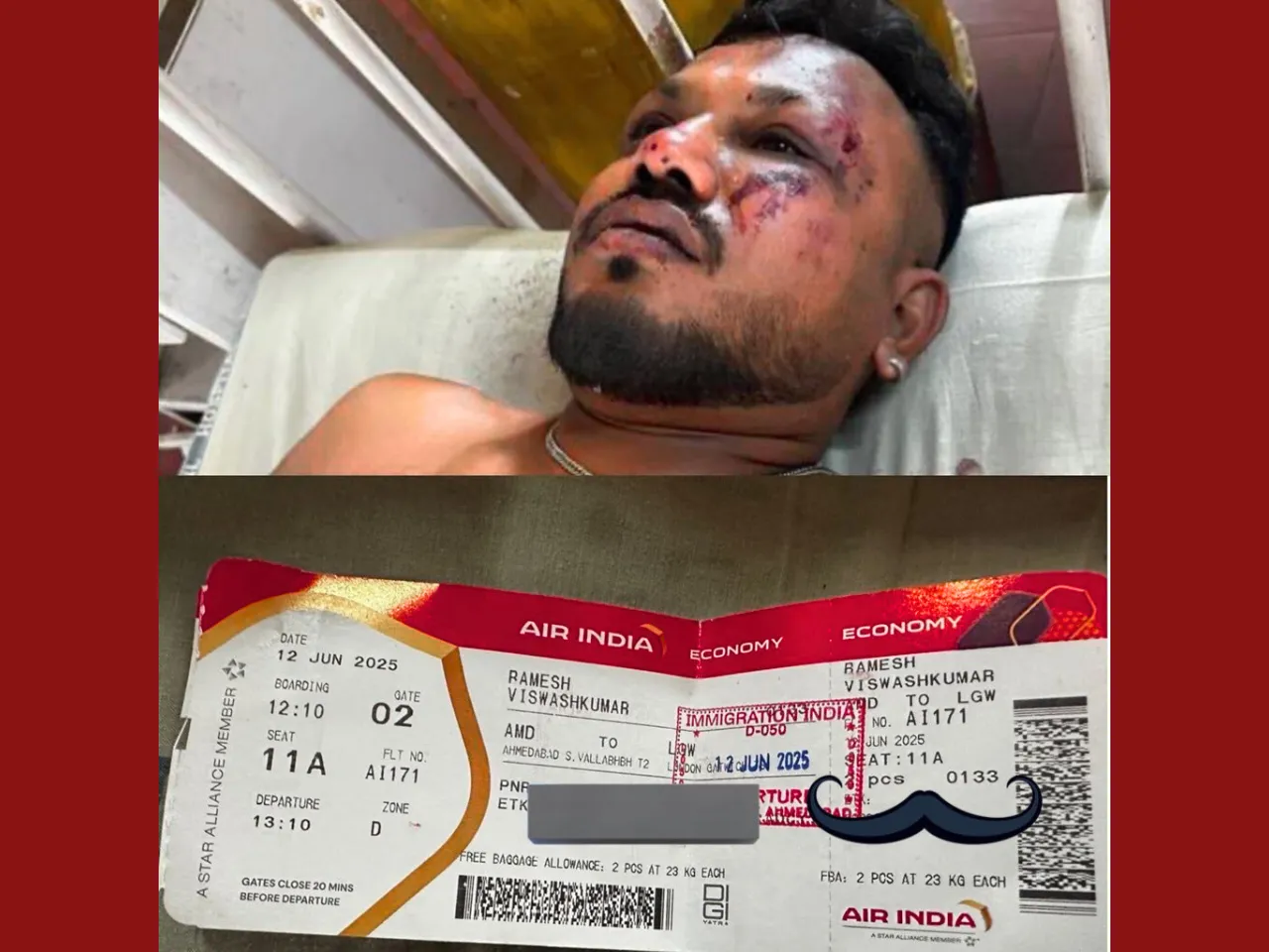 Ahmedabad Air India Crash Surviver
