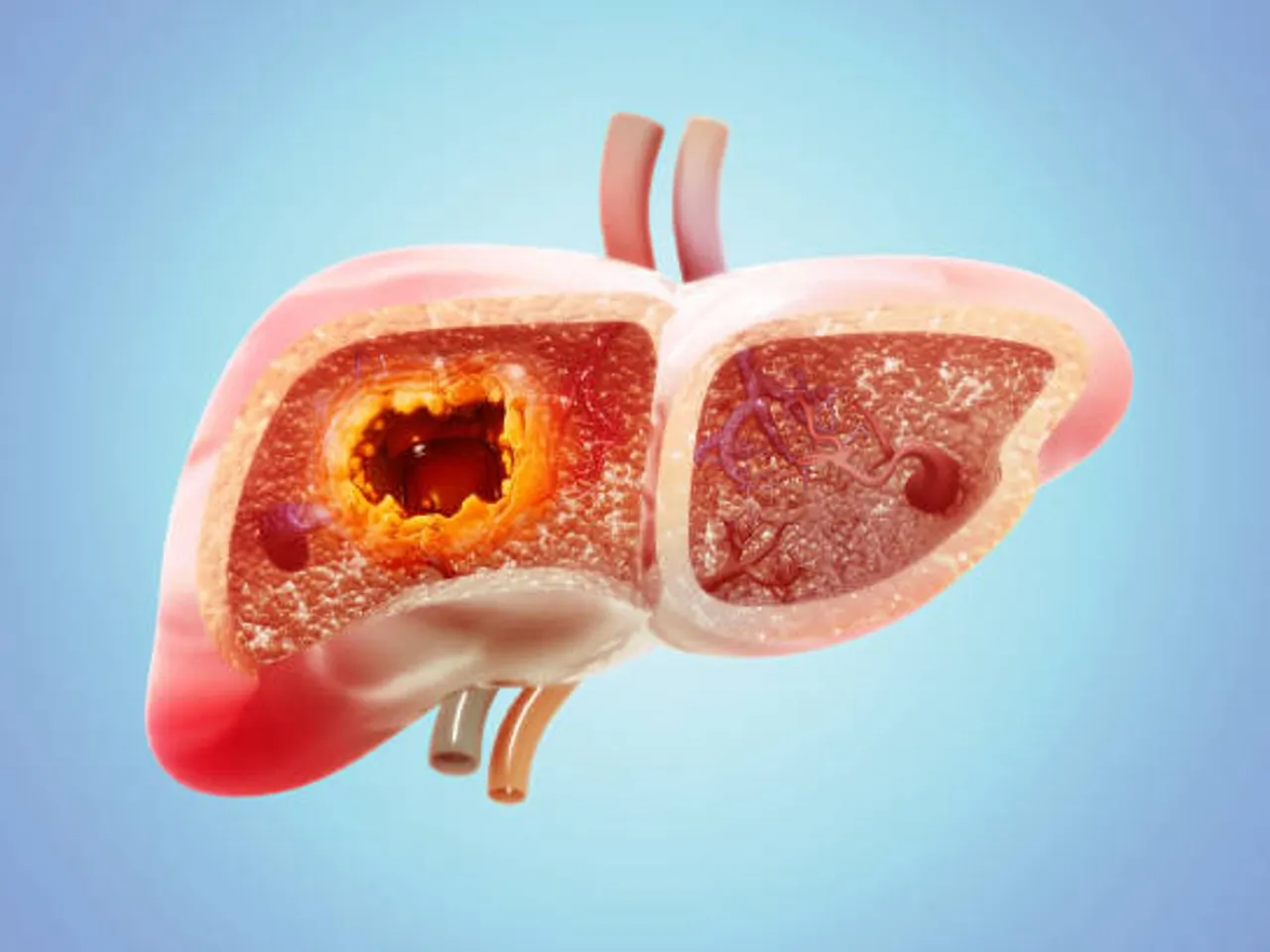 இயற்கையான முறையில் கல்லீரலை பாதுகாக்க சிம்பிள் டிப்ஸ் இதோ!