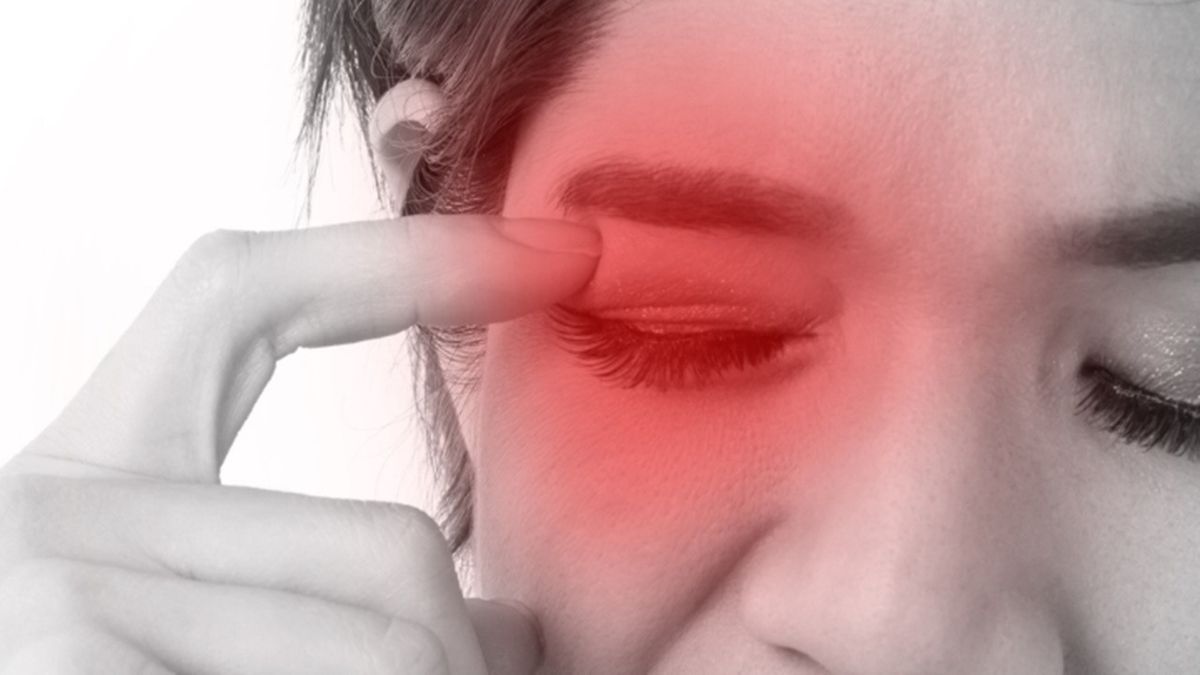 ব্লেফারাইটিস