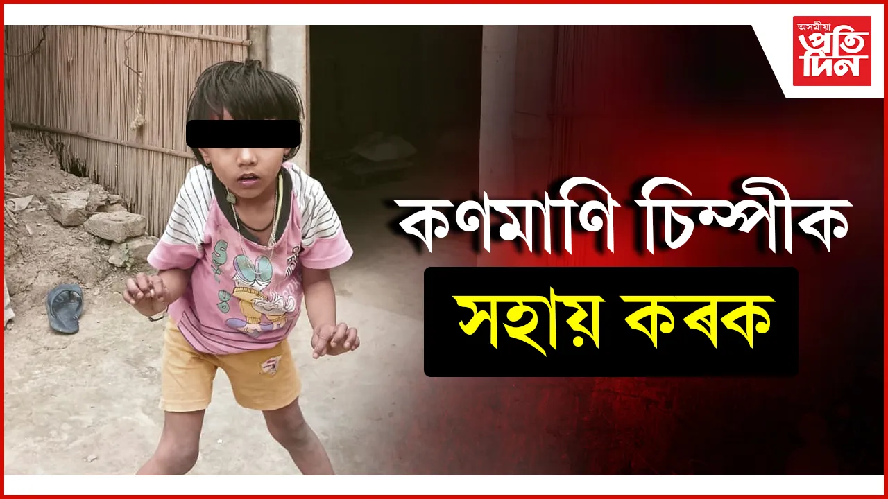 কণমাণি চিম্পীক সহায় কৰক