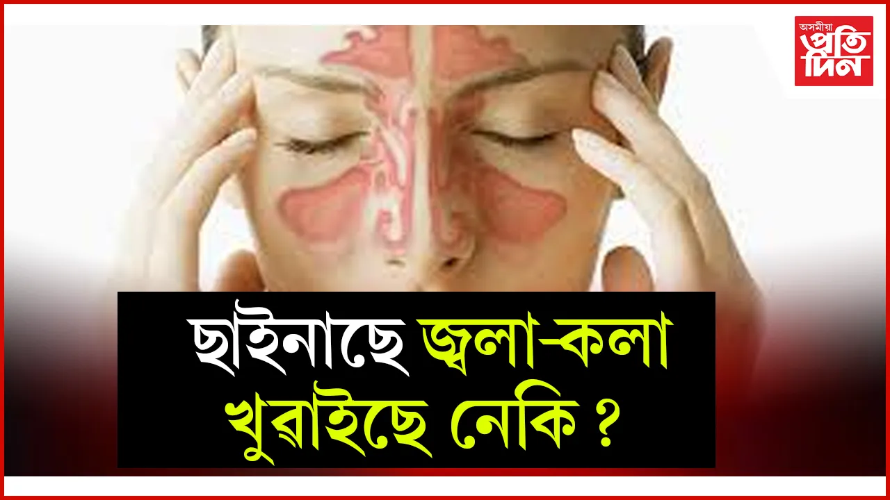 ছাইনাছে  web