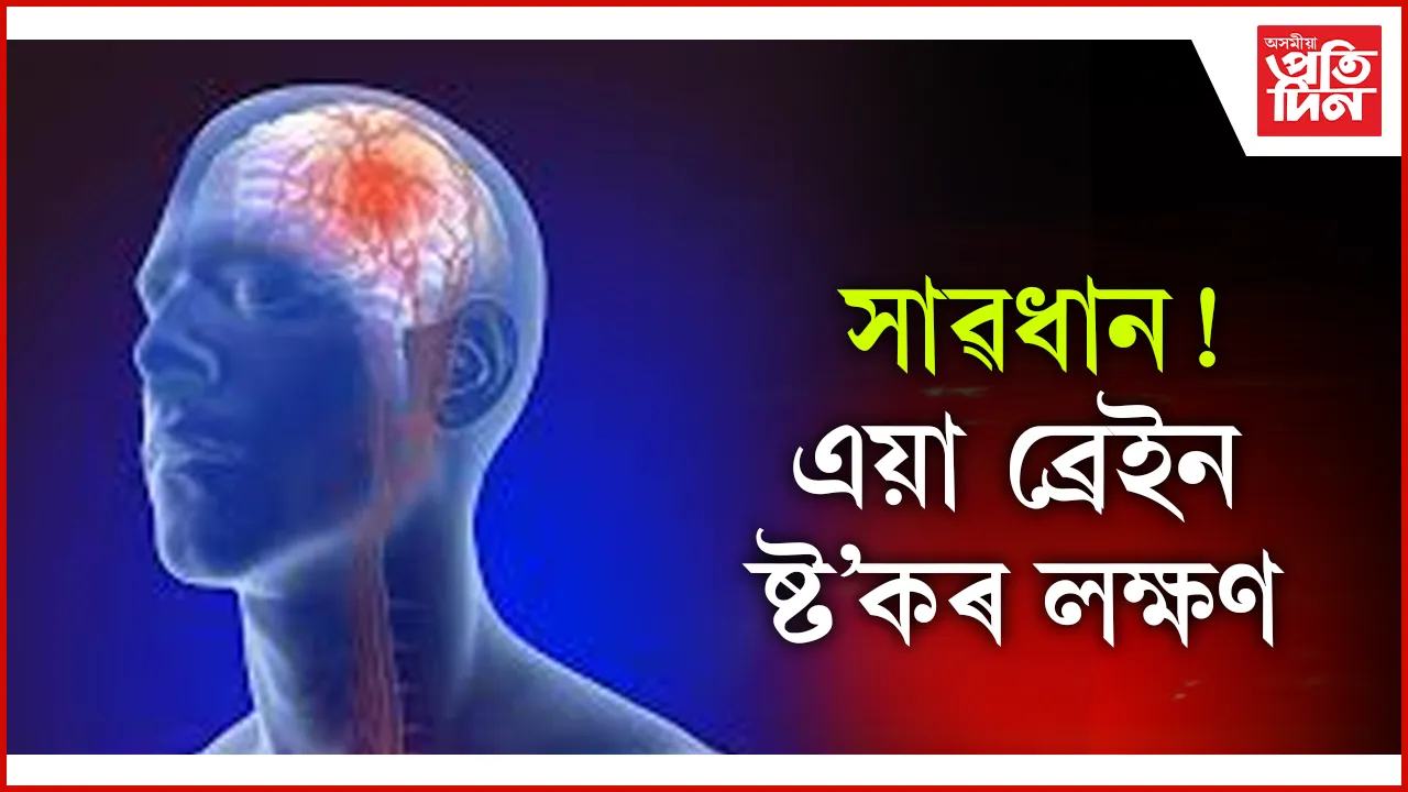 ব্ৰেইন ষ্ট'ক seo (1)