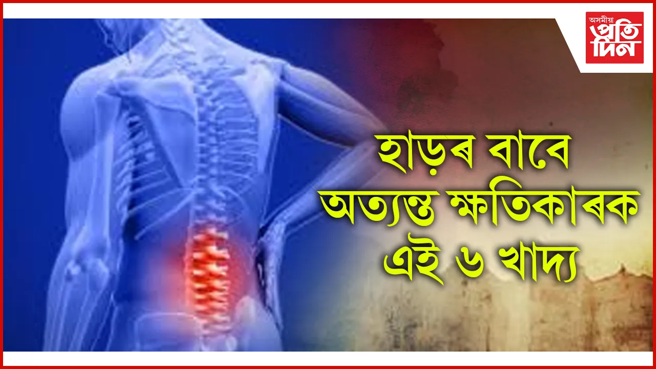 seo  হাড়