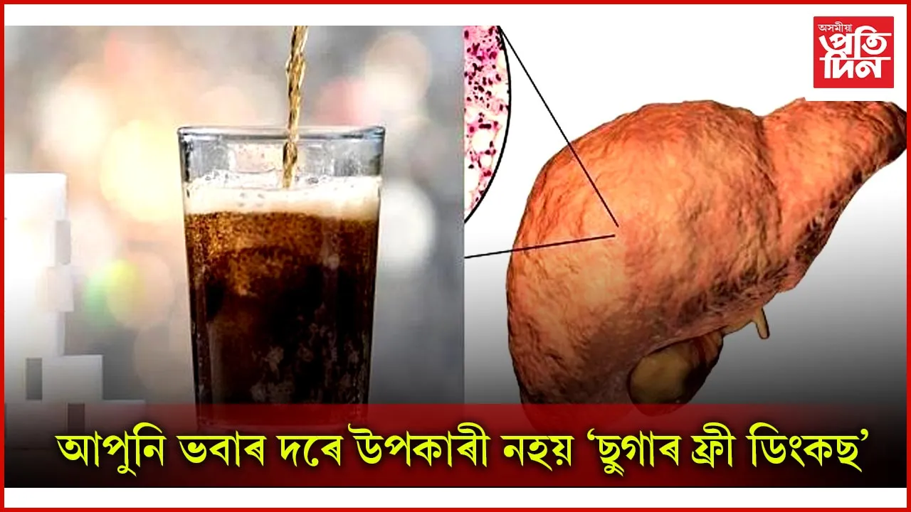 'ছুগাৰ ফ্ৰী ডিংকছ'