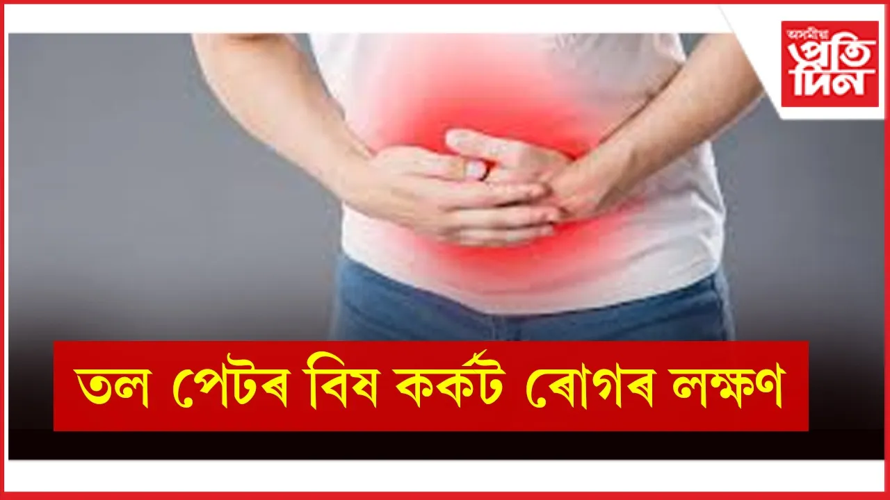 কৰ্কট ৰোগ seo