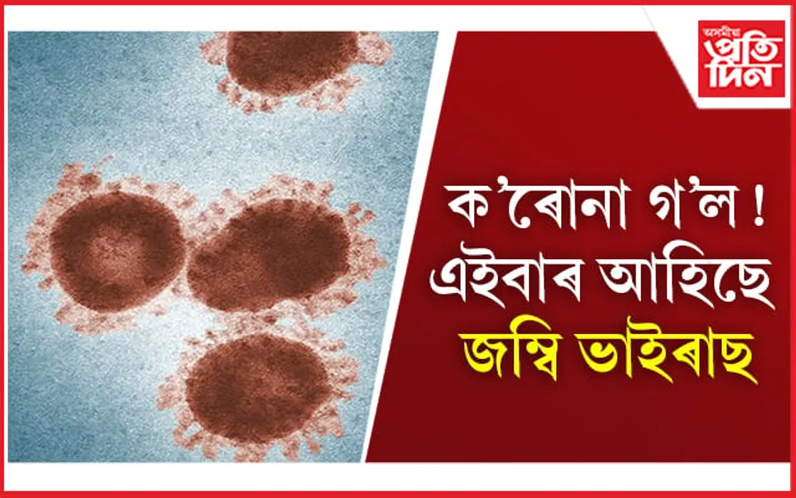 Zombie Virus: ক’ৰোনা গ’ল ! এইবাৰ আহিছে জম্বি ভাইৰাছ 