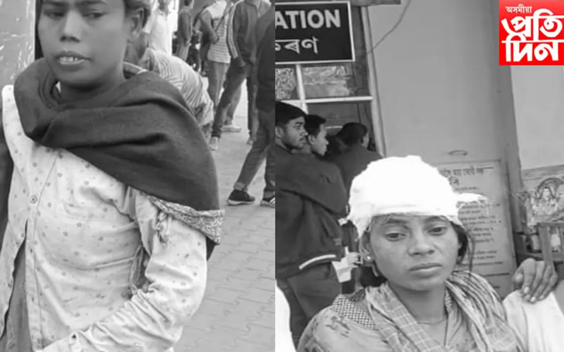 নামৰূপত ভয়ংকৰ ঘটনা! শিলৰ কোঁৱেৰীৰ ক্ৰাচাৰ মেছিনত সোমাল ৩ গৰাকী মহিলা