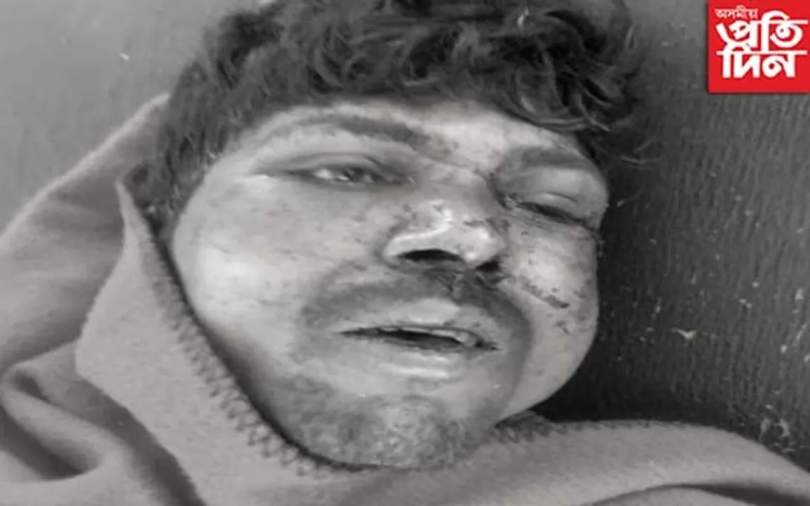 নগাঁৱত এইবাৰৰ চোৰৰ লক্ষ্য শিশু...