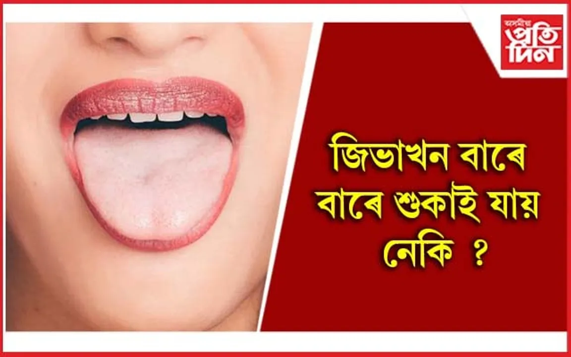 এয়া বেমাৰৰ লক্ষণ, অৱহেলা নকৰিব