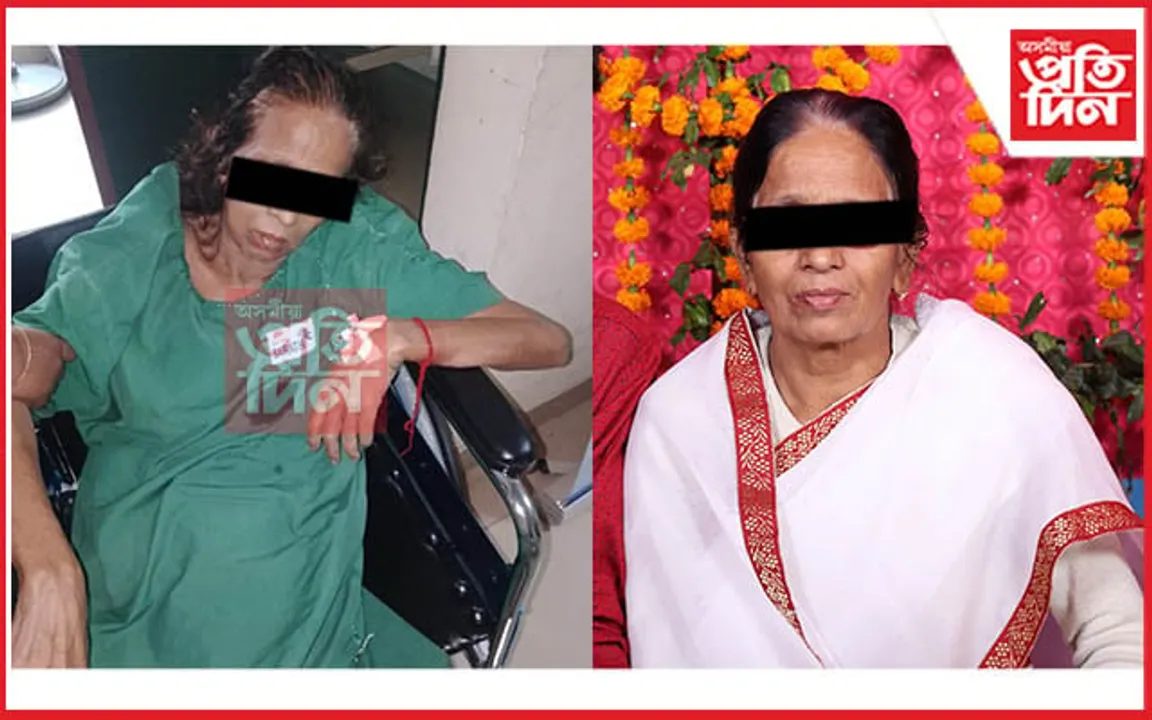 'সাৰথি' হাস্পতালত মহিলাৰ মৃত্যুক লৈ উত্তপ্ত পৰিস্থিতি...