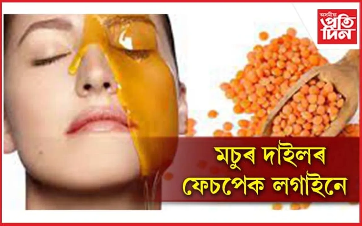 ছালৰ হাজাৰটা সমস্যাৰ সমাধান দিয়ে মচুৰ দাইলে