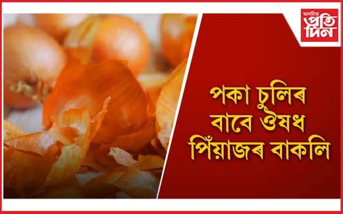 চুলিত পিঁয়াজৰ বাকলি কিদৰে ব্যৱহাৰ কৰিব পাৰি জানি লওঁক