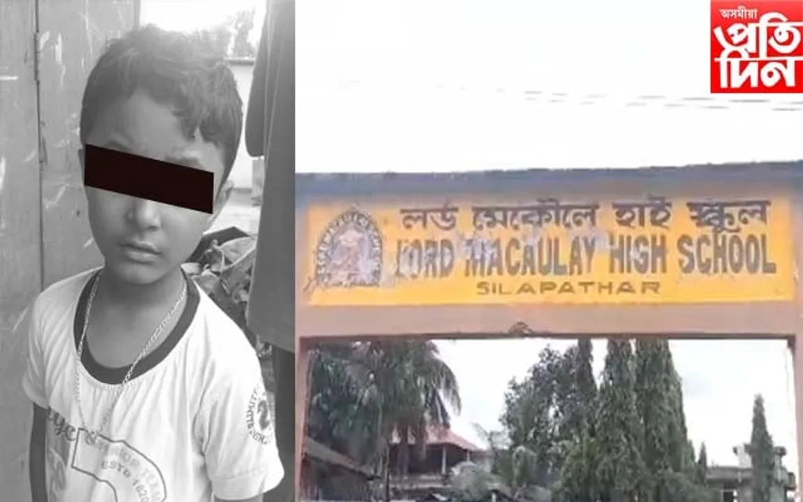 চিলাপথাৰত ছাত্ৰৰ ওপৰত শিক্ষকৰ নিৰ্মম প্ৰহাৰ