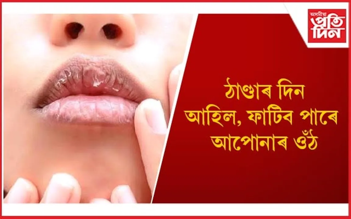 ফটা ওঁঠ মসৃণ কৰাৰ ঘৰুৱা উপায়সমূহ জানি লওঁক