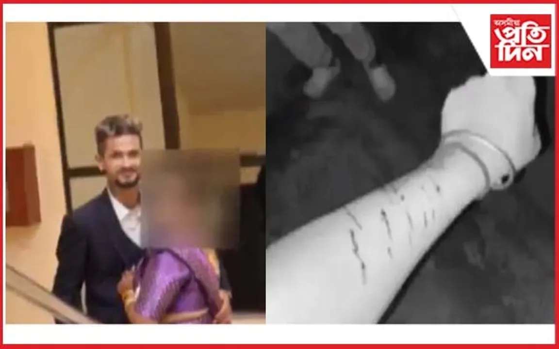 পুনৰ নিৰ্যাতনৰ বলি বোৱাৰী : দেহত তেল ধালি জ্বলাই দিয়াৰ অপচেষ্টা স্বামী পৰিয়ালৰ