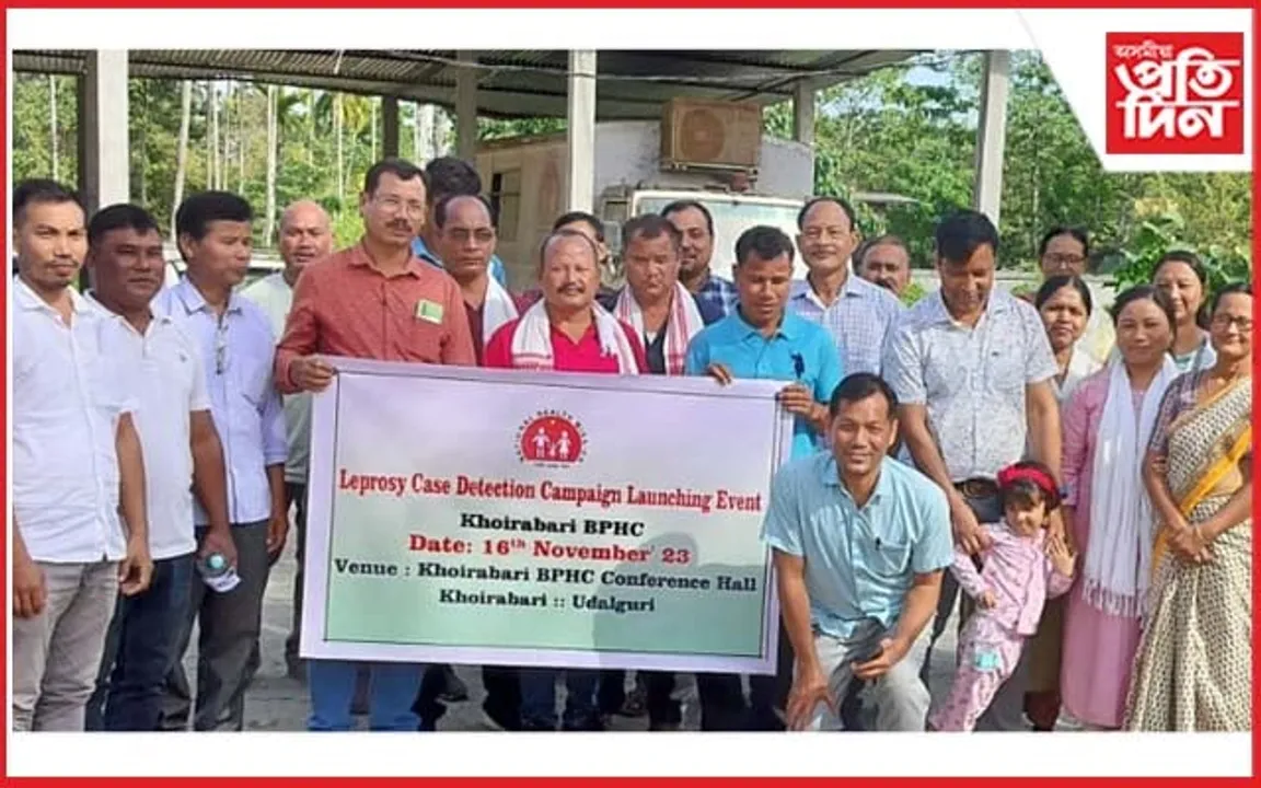 ওদালগুৰিত কুষ্ঠৰোগ চিনাক্তকৰণ অভিযান আৰম্ভ 