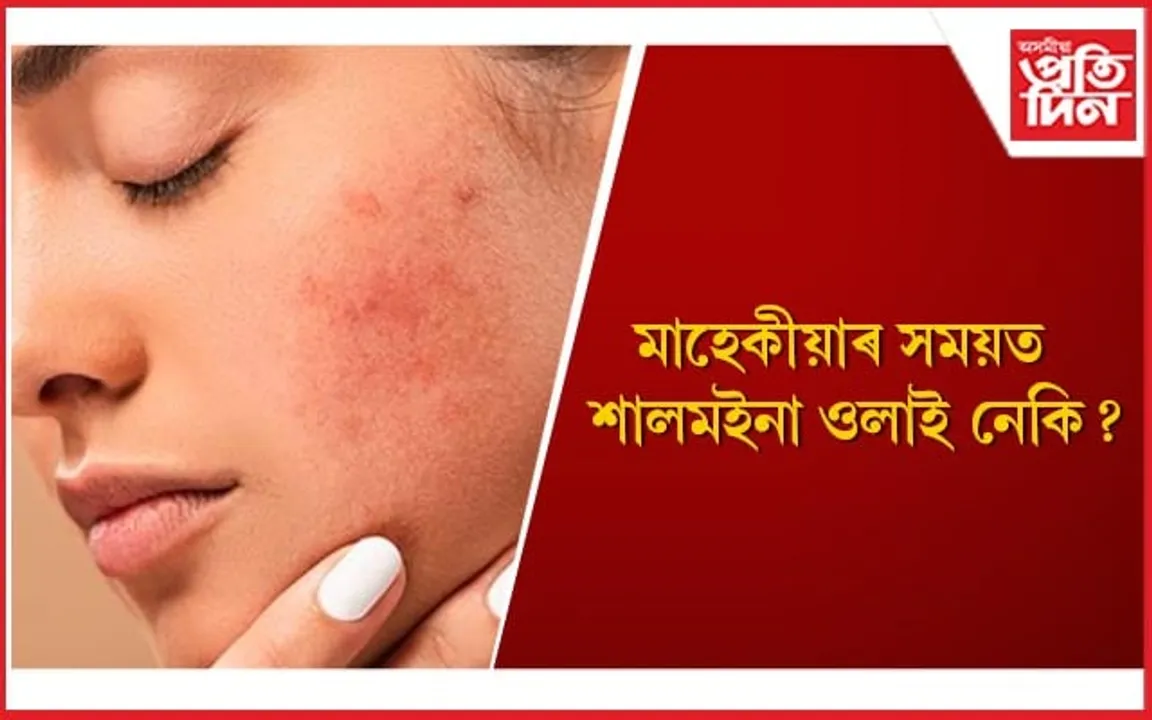 মাহেকীয়াৰ কেইদিনত এইদৰে লওঁক ছালৰ যতন