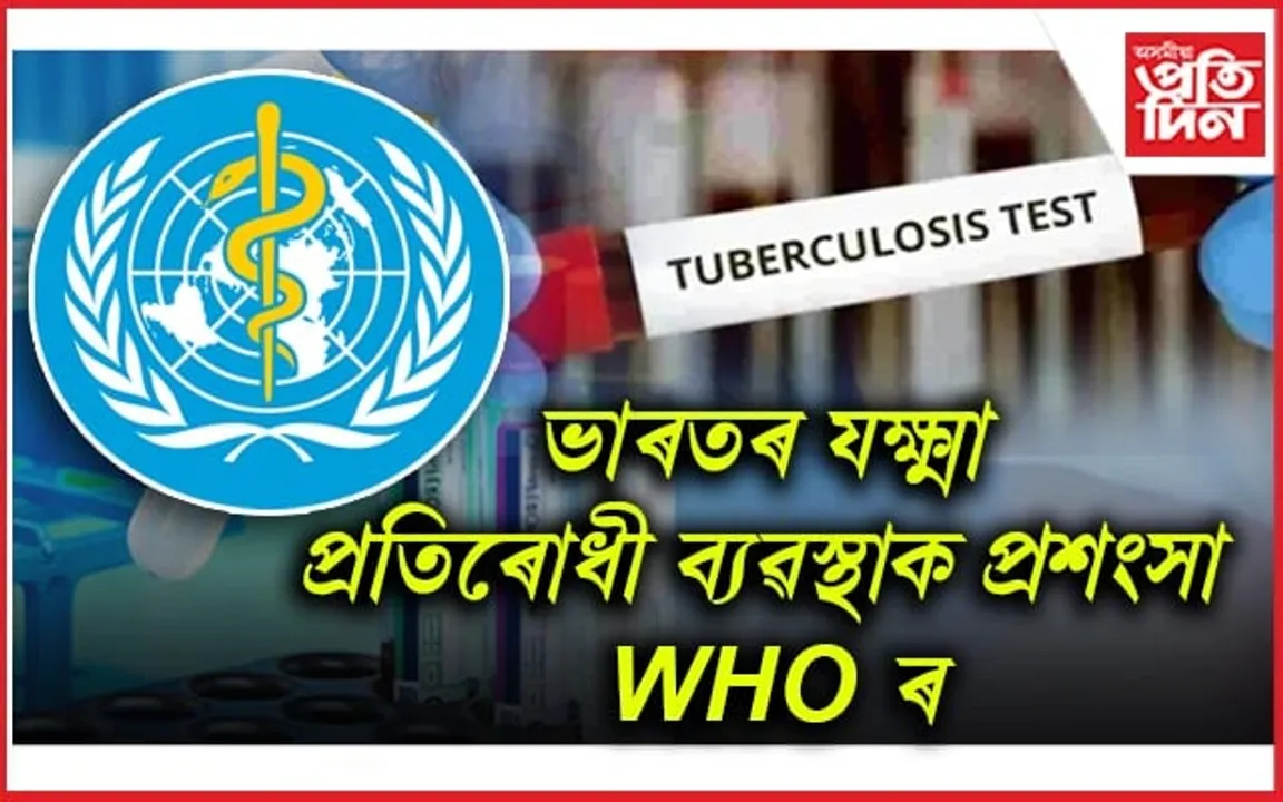ভাৰতৰ যক্ষ্মা প্ৰতিৰোধী ব্যৱস্থাক প্ৰশংসা WHOৰঃ বিশ্বত ৮ শতাংশ, ভাৰতত ১৮ শতাংশ ৰোগী হ্ৰাস...