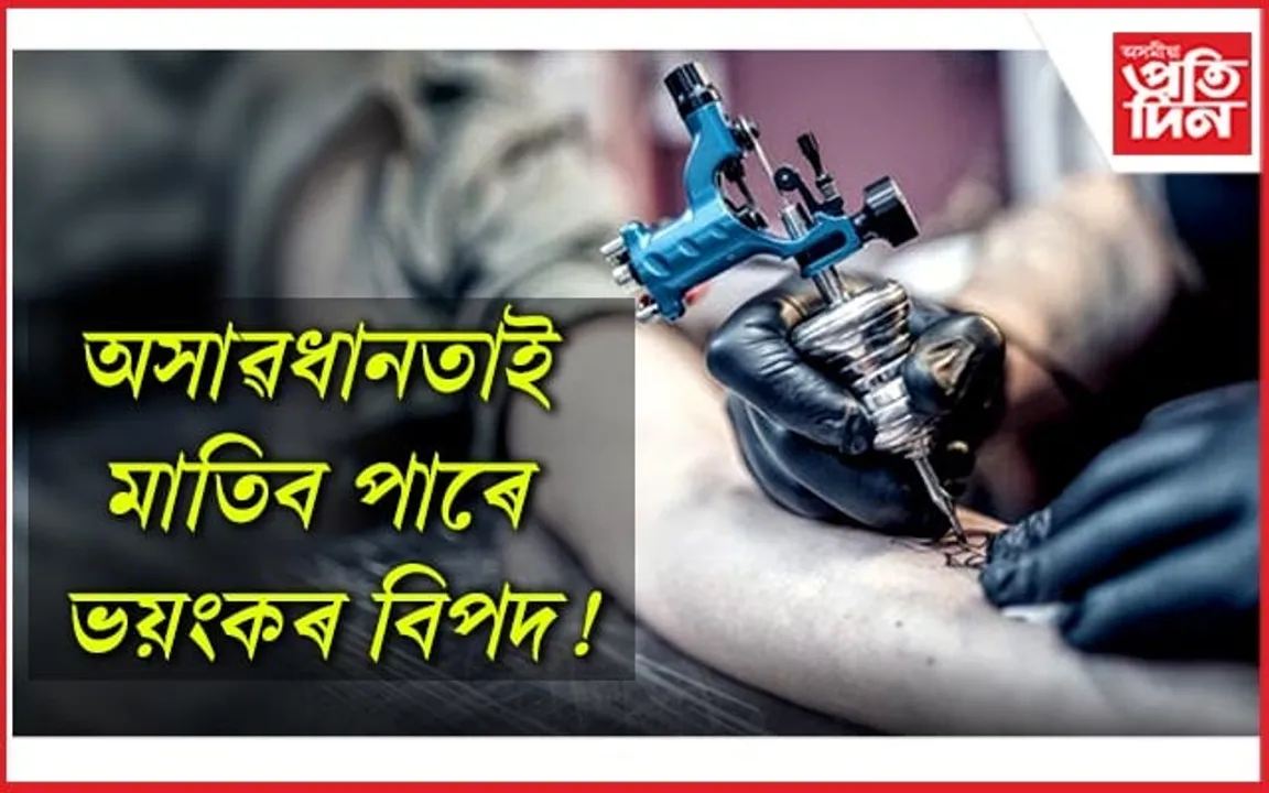 সাৱধান : টাটু আঁকি এইচ আই ভিত আক্ৰান্ত কুৰিজন