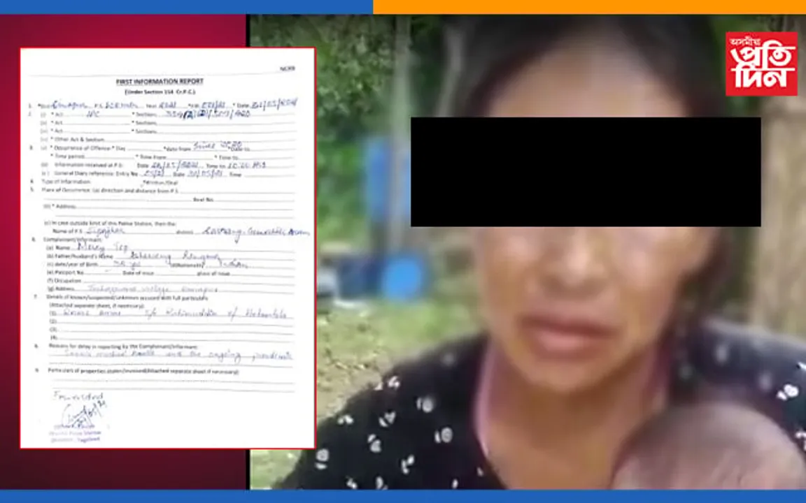 কোভিডৰ আন্ধাৰ নিশা ছিপাঝাৰৰ আৱদ্ধ কোঠাত বিবস্ত্ৰ হোৱা ডিমাপুৰৰ অসহায় শিক্ষয়িত্ৰী…