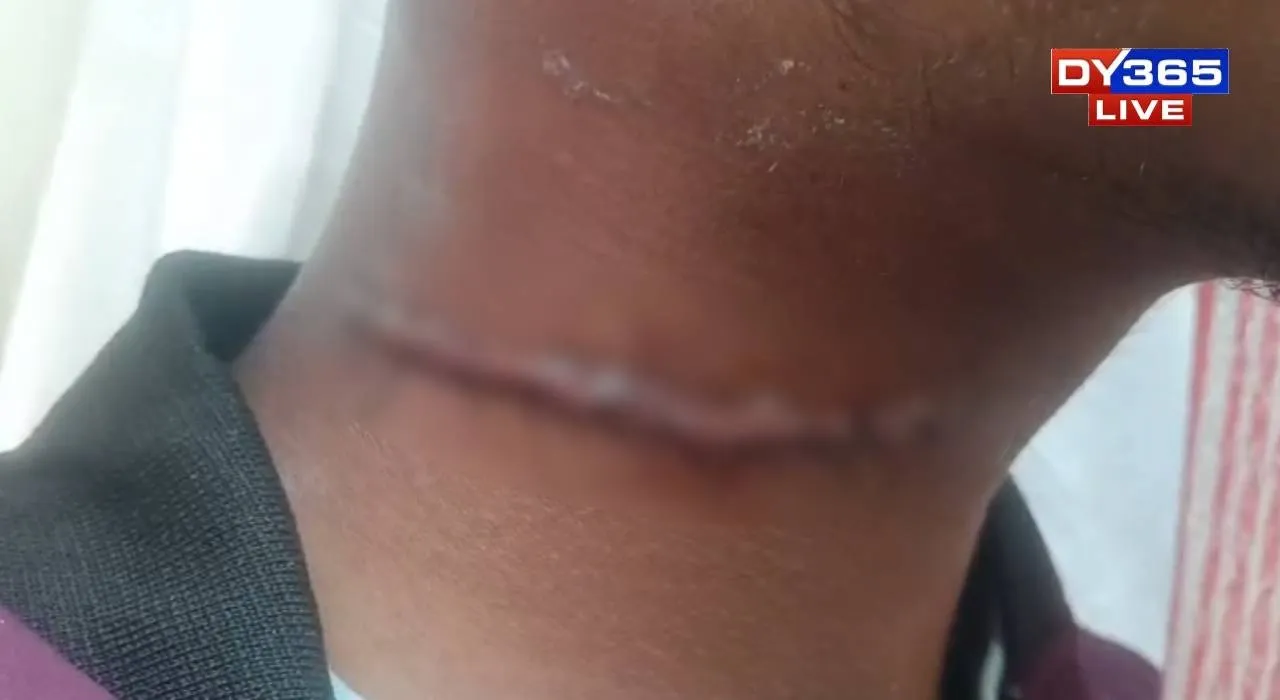  The victim was assaulted with a blade, sustaining 15 deep cuts and left in critical condition 