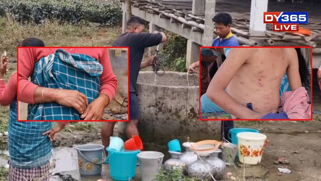  A Silent Threat in the Water? Children and Elderly Fall Ill in Assam's Jonai