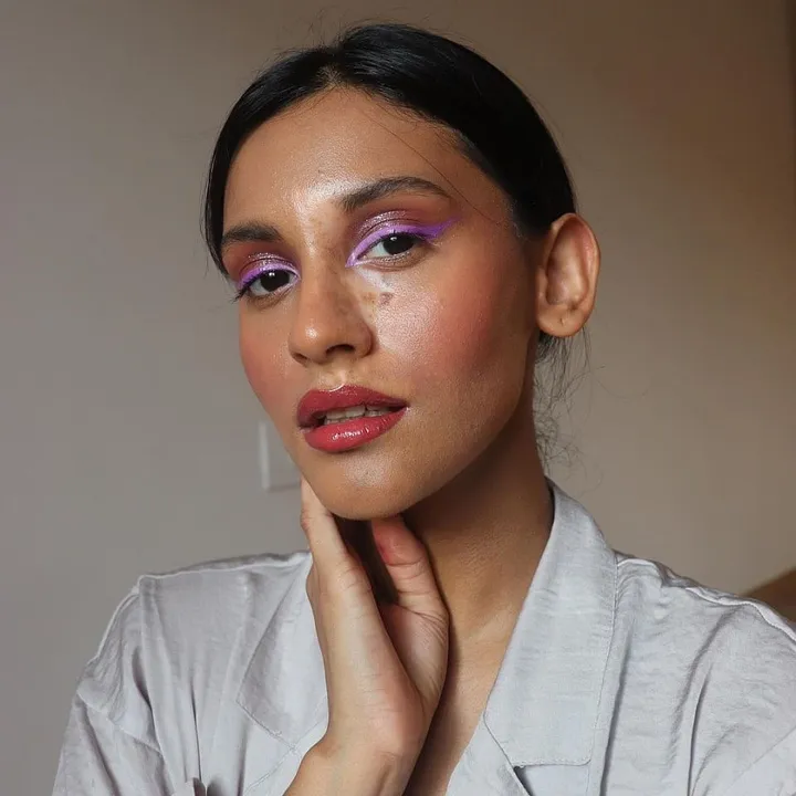 The Instagrammer with vitiligo is changing the way we perceive beauty 