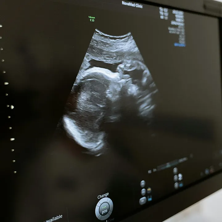 A guide to understanding the realities of IVF