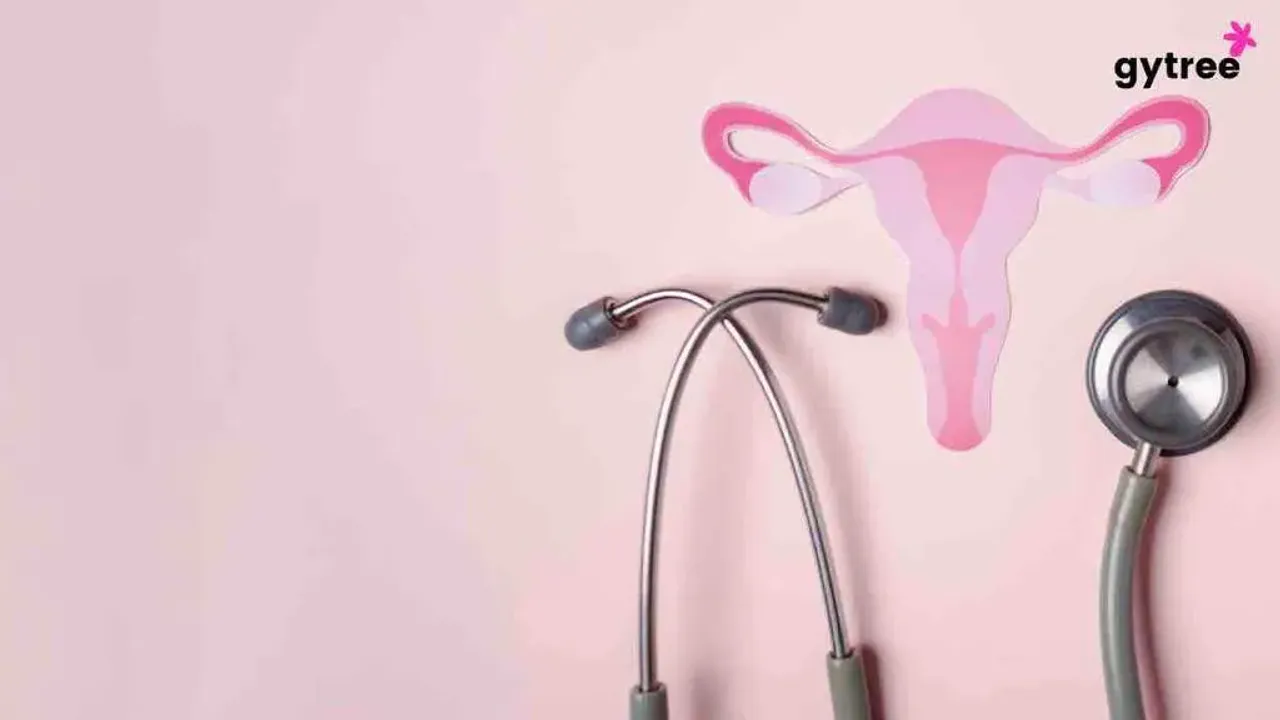 Borderline PCOS: Management and Well-Being