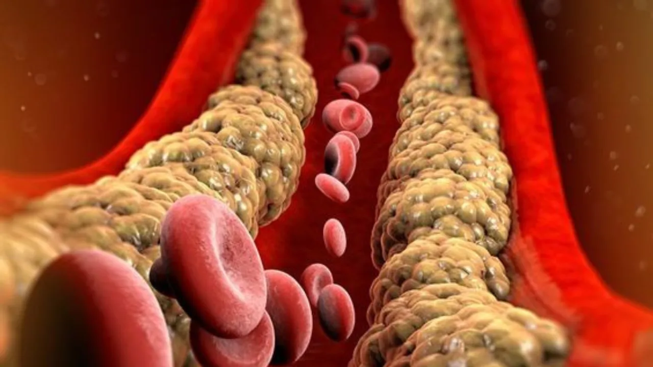 Cholesterol (Pinterest).png