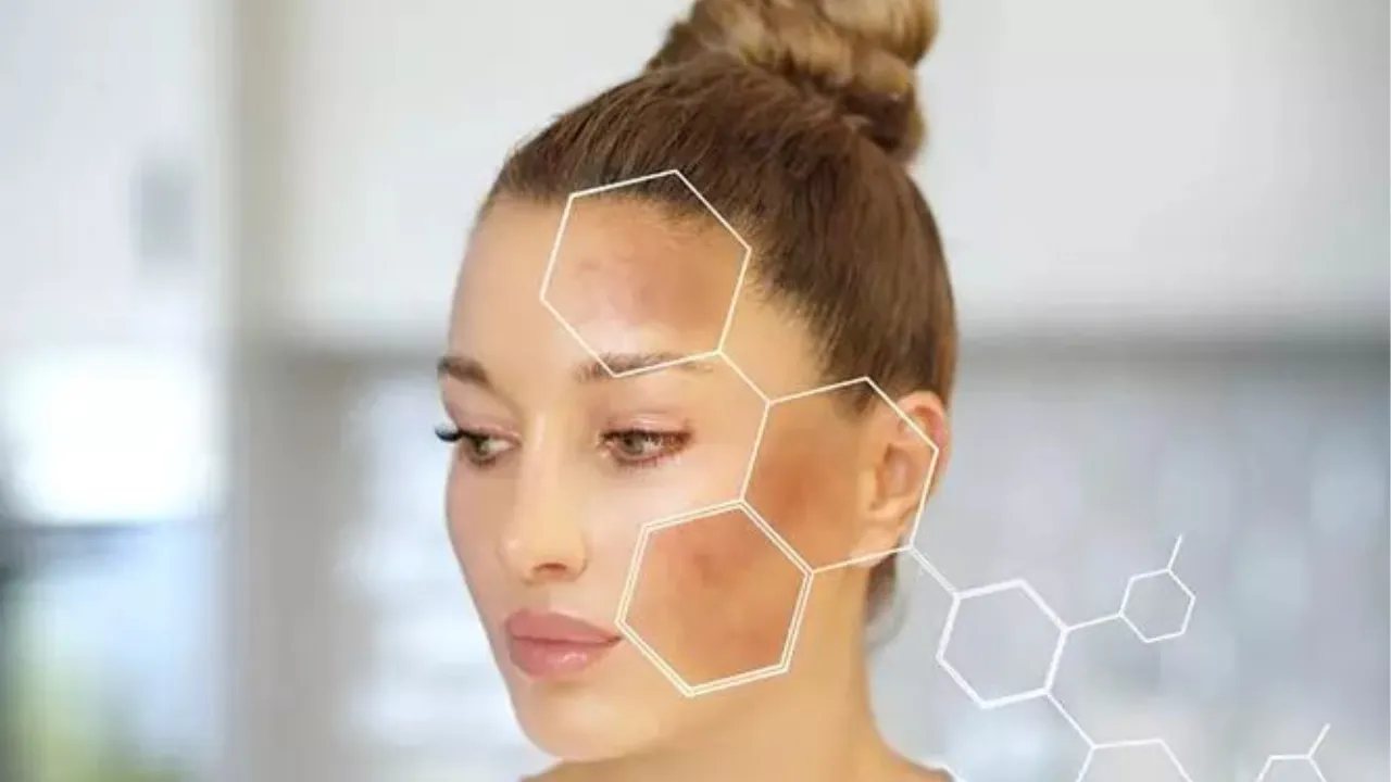 Dark Spots( Freepik)