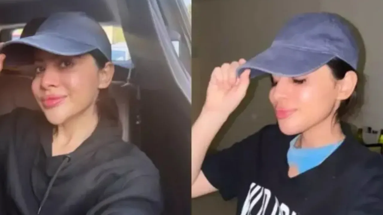 Uorfi Javed Shares Decision To Dissolve Chin Fillers